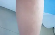 治疗图