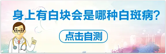 白癜风症状