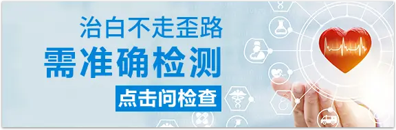 白癜风诊断