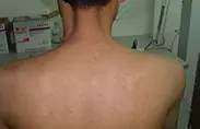 治疗图